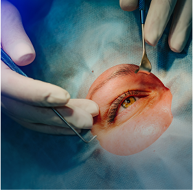 Glaucoma